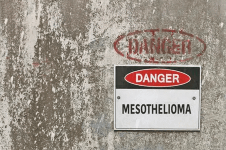 danger mesothelioma sign